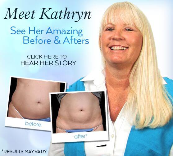 See Kathryn's Amazing Before & After Results
