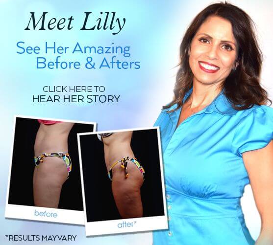 See Lilly's Amazing Before & After Results