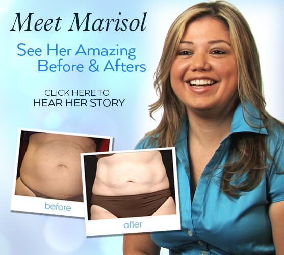 See Marisol's Amazing Aqualipo Before and Afters